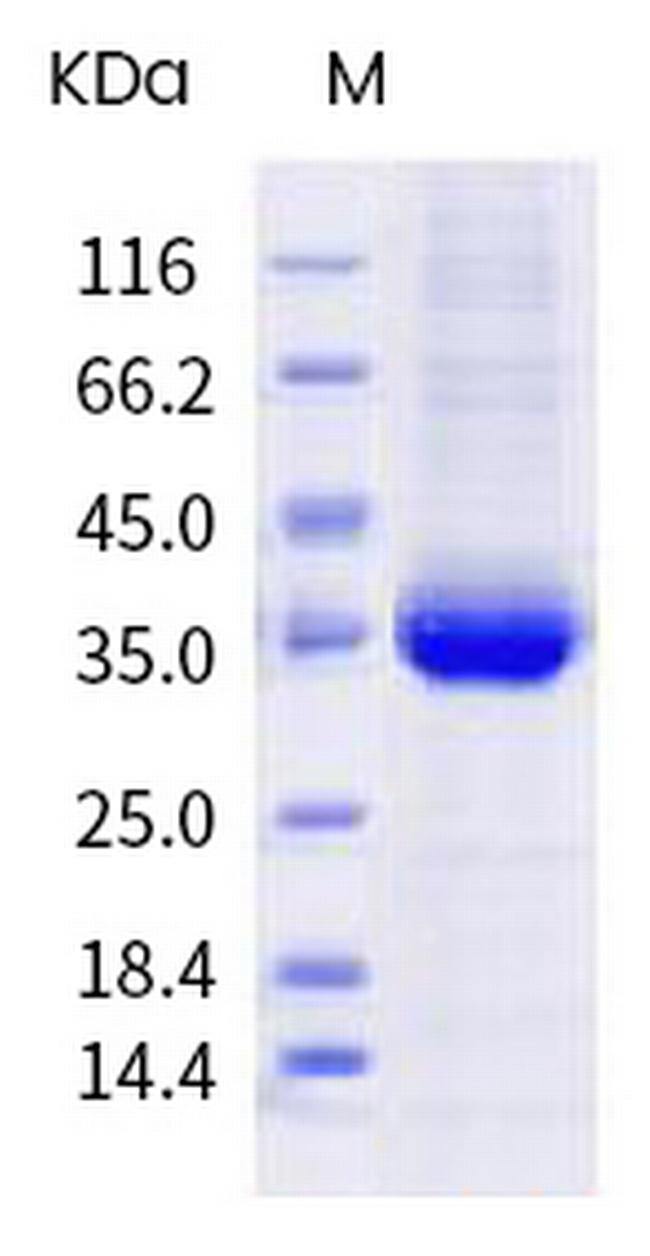 SARS-CoV-2 Spike Protein (RBD) (G502V) His-tag Protein