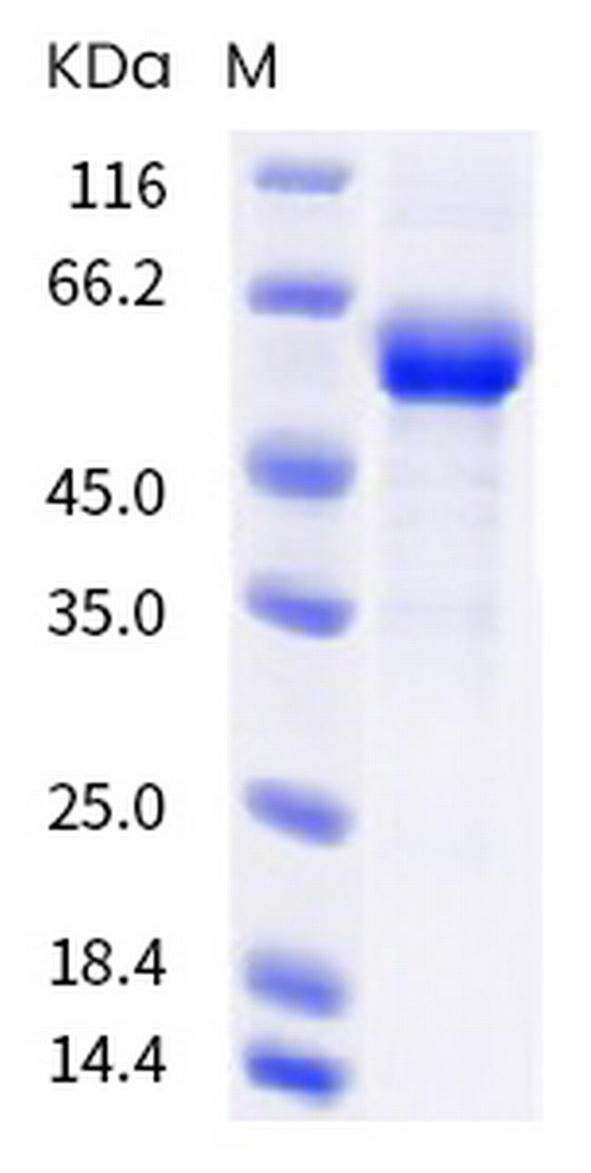 SARS-CoV-2 Spike Protein (RBD) (B.1.351) Fc Chimera Protein