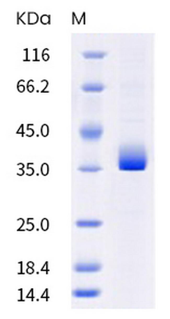 SARS-CoV-2 Spike Protein (RBD) (B.1.351) His-Avi Tag Protein