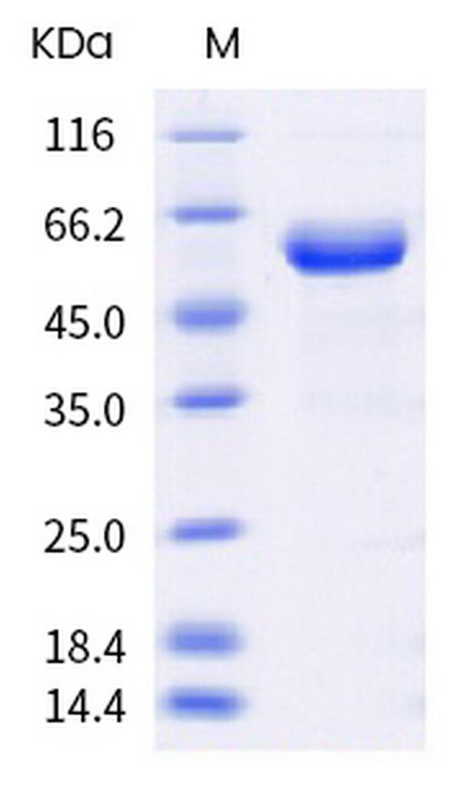 SARS-CoV-2 Spike Protein (RBD) (P.1) Fc Chimera Protein