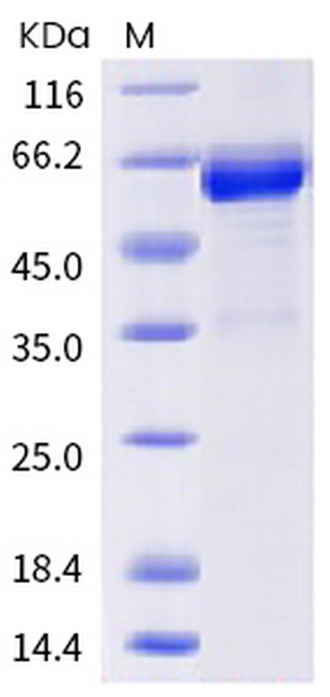 SARS-CoV-2 Spike Protein (RBD) (C.37) Fc Chimera Protein