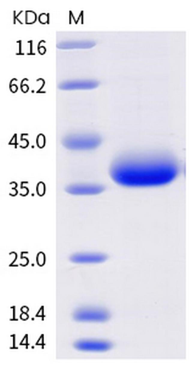 SARS-CoV-2 Spike Protein (RBD) (C.37) His-Avi Tag Protein