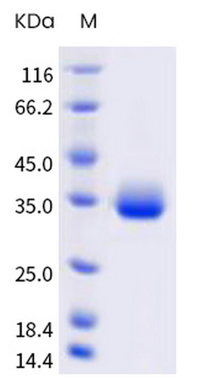 SARS-CoV-2 Spike Protein (RBD) (C.37) His-tag Protein