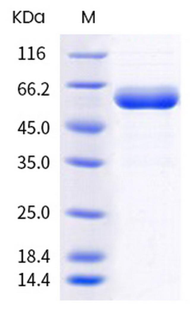 SARS-CoV-2 Spike Protein (RBD) (B.1.617) Fc Chimera Protein