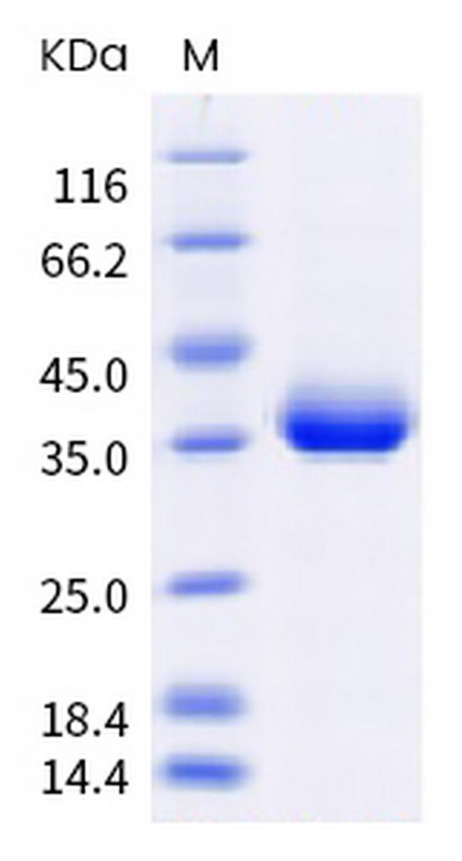 SARS-CoV-2 Spike Protein (RBD) (B.1.617) His-Avi Tag Protein