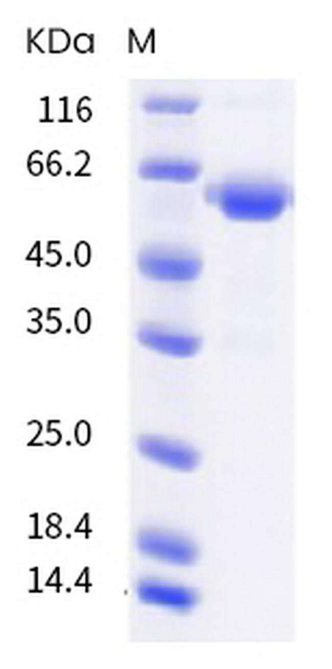 SARS-CoV-2 Spike Protein (RBD) (B.1.617.2) Fc Chimera Protein