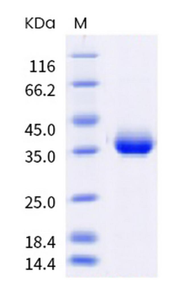 SARS-CoV-2 Spike Protein (RBD) (B.1.617.2) His-Avi Tag Protein