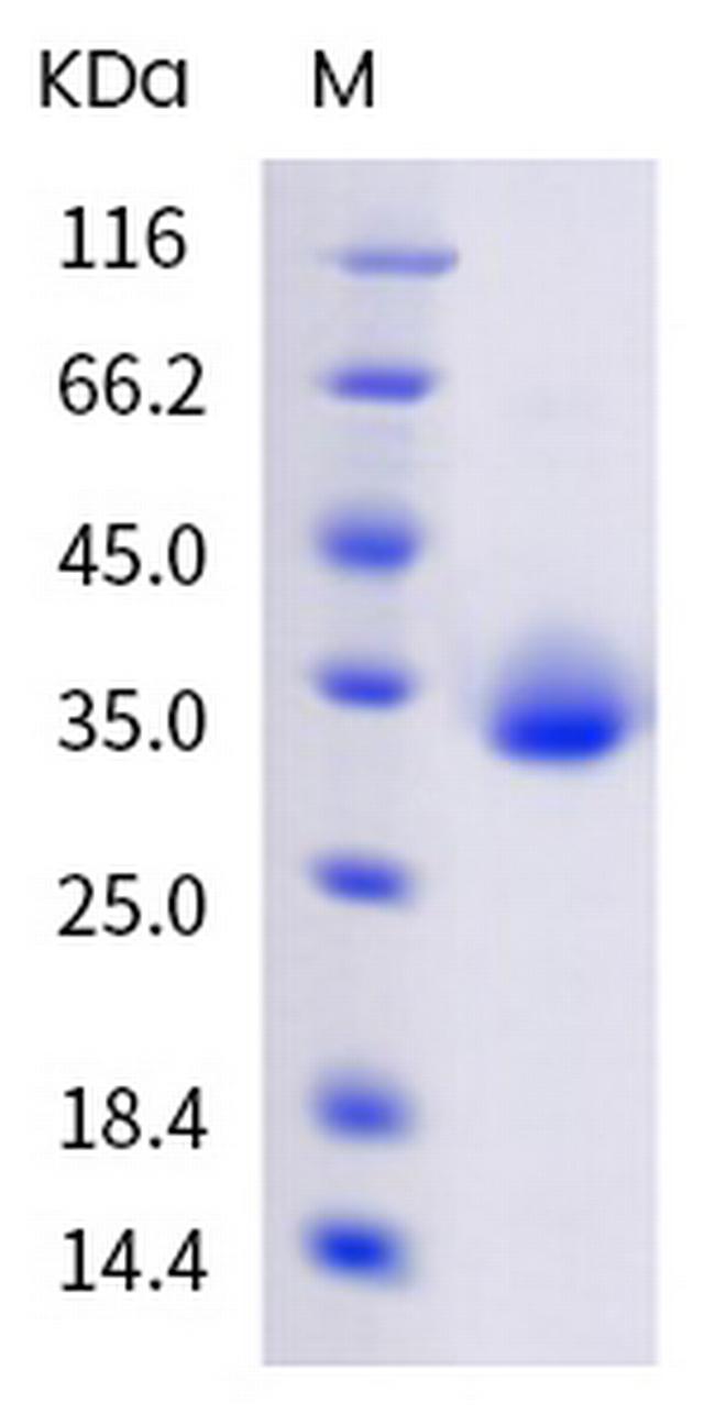 SARS-CoV-2 Spike Protein (RBD) (B.1.630) His-tag Protein