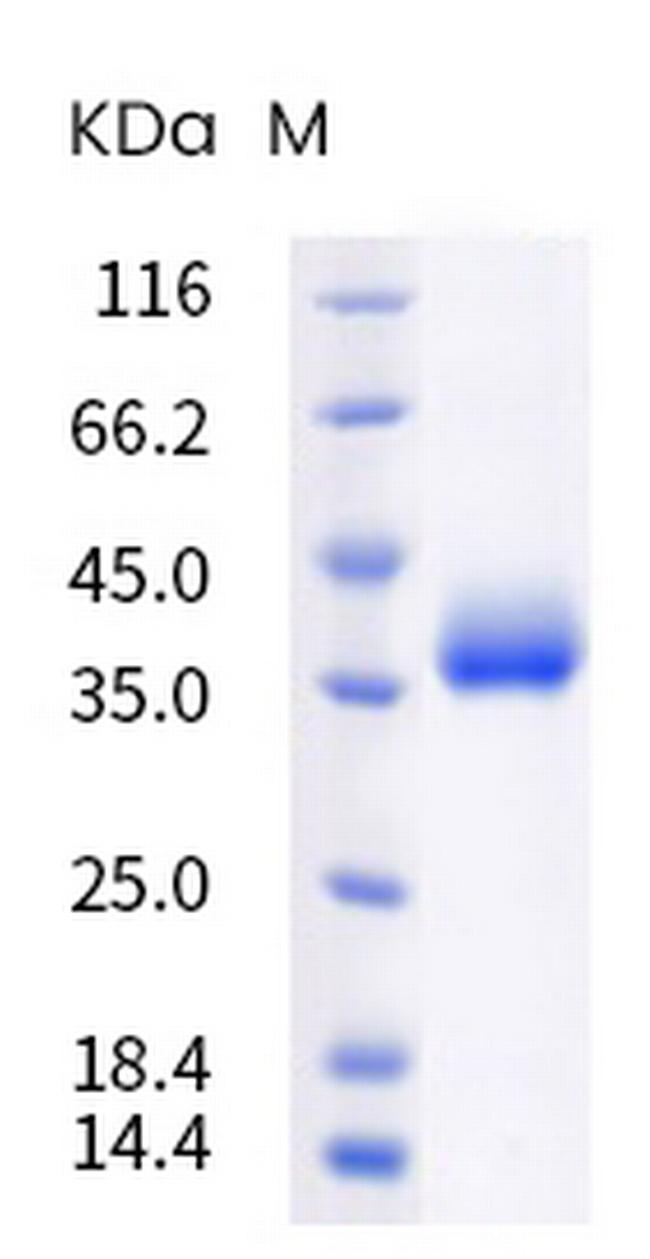 SARS-CoV-2 Spike Protein (RBD) (B.1.617.2) His-tag Protein