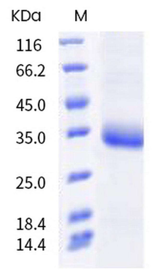 SARS-CoV-2 Spike Protein (RBD) (N440D) His-tag Protein