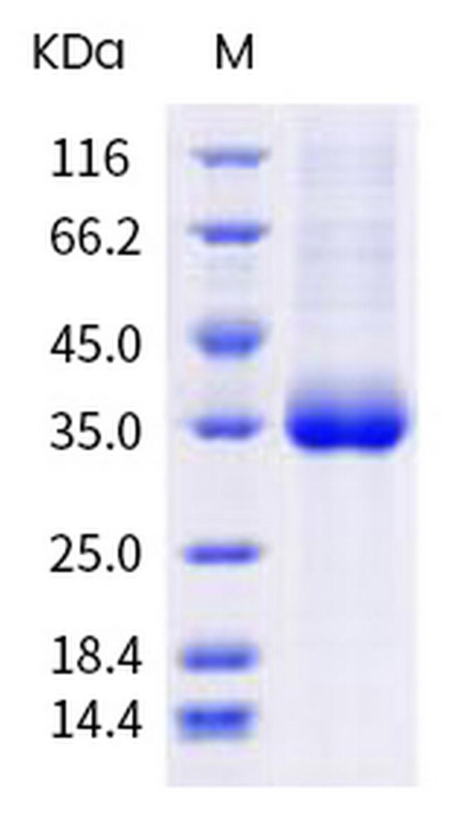 SARS-CoV-2 Spike Protein (RBD) (N481K) His-tag Protein