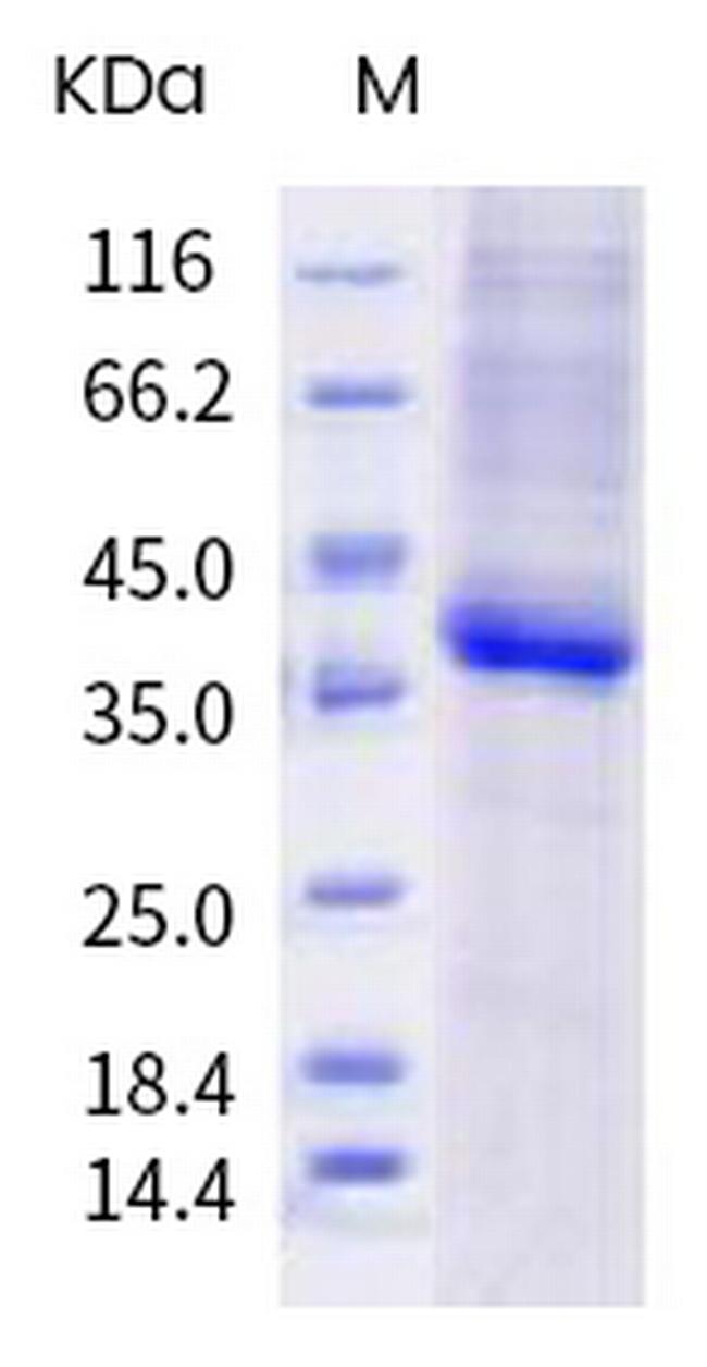 SARS-CoV-2 Spike Protein (RBD) (N487D) His-tag Protein