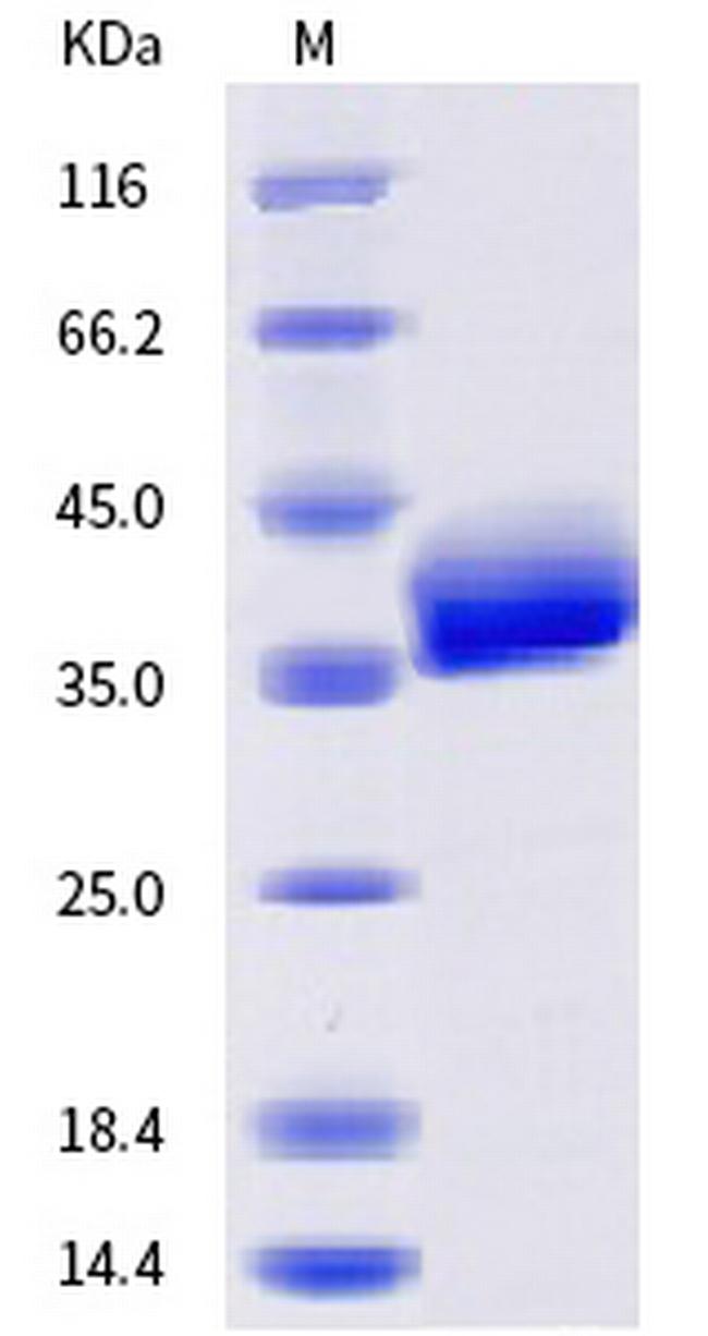 SARS-CoV-2 Spike Protein (RBD) (N501S) His-tag Protein