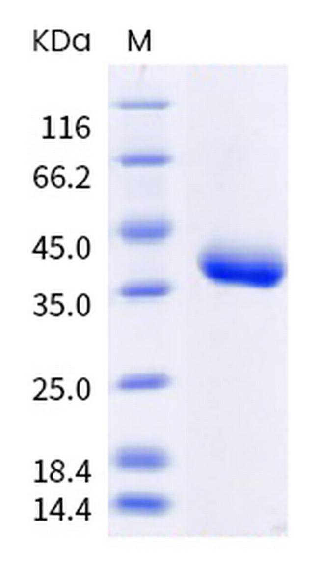 SARS-CoV-2 Spike Protein (RBD) (N501Y) His-Avi Tag Protein