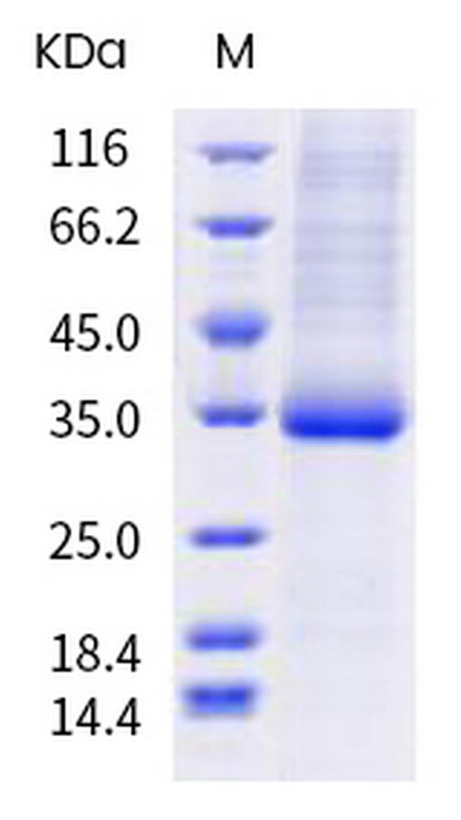 SARS-CoV-2 Spike Protein (RBD) (P479L) His-tag Protein