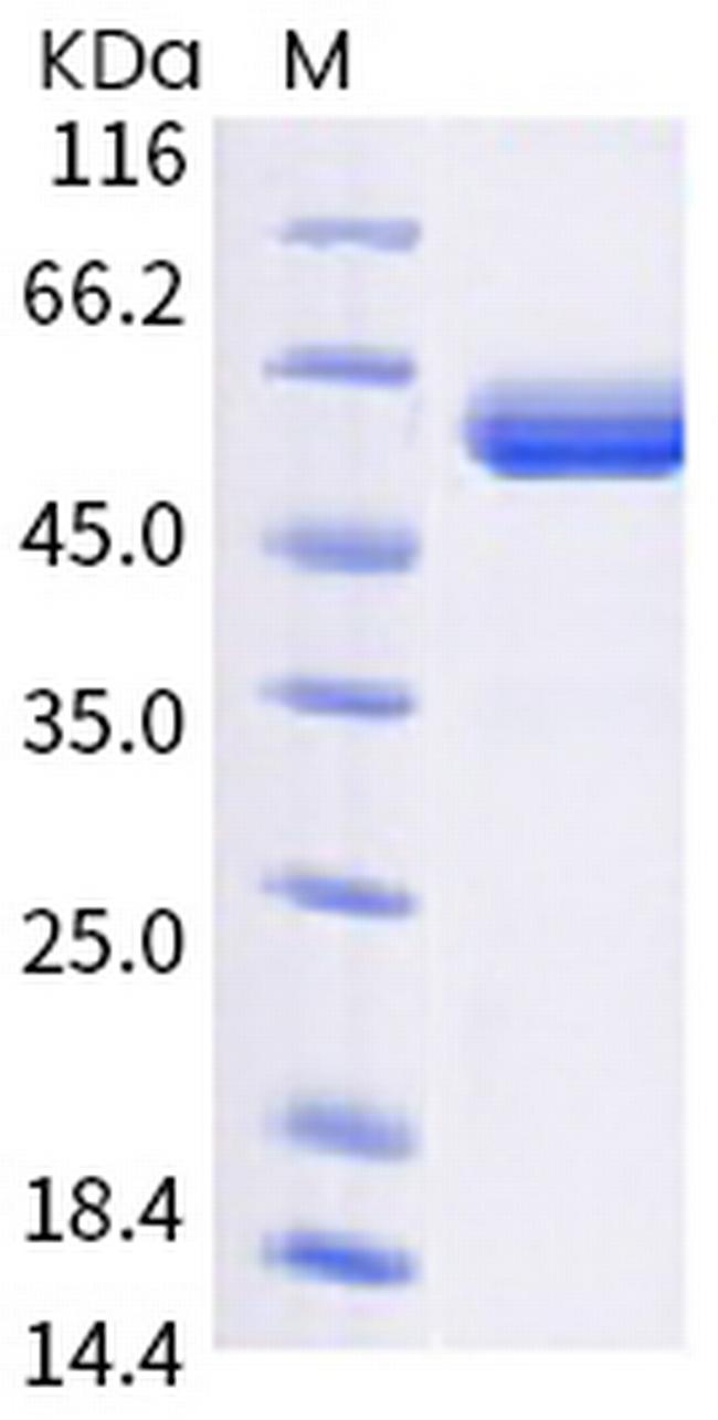 SARS-CoV-2 Spike Protein (RBD) (B.1.6221) Fc Chimera Protein