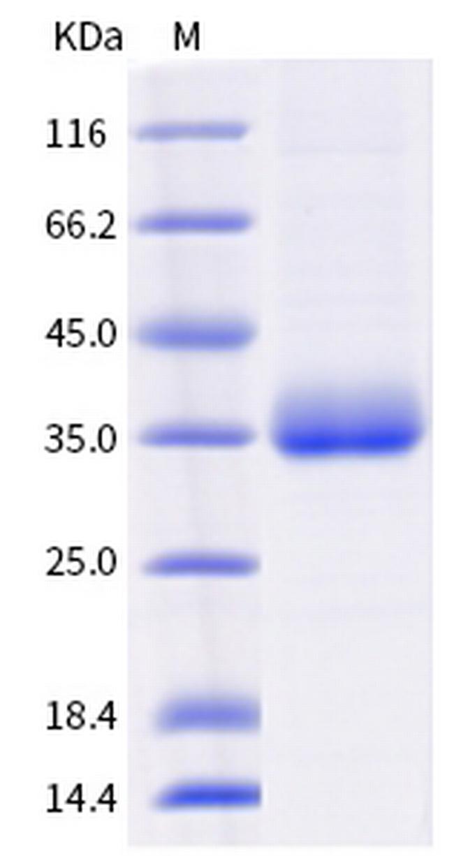SARS-CoV-2 Spike Protein (RBD) (B.1.621) His-tag Protein