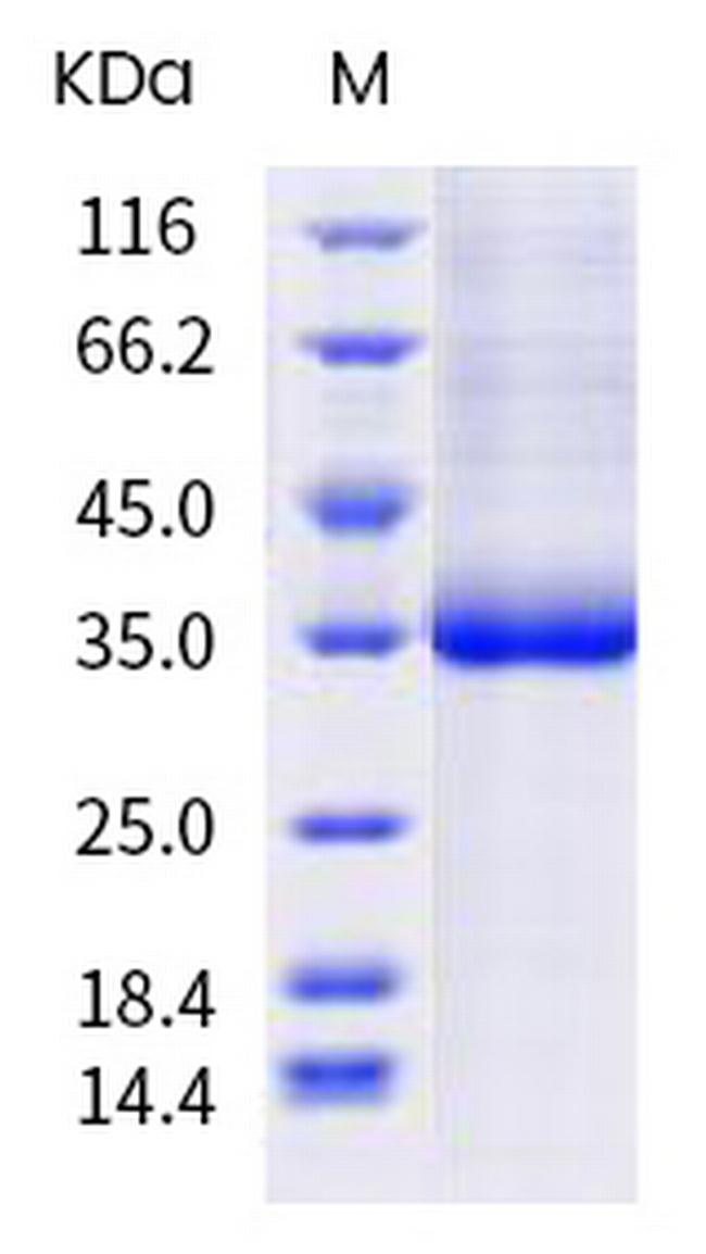 SARS-CoV-2 Spike Protein (RBD) (S477G) His-tag Protein