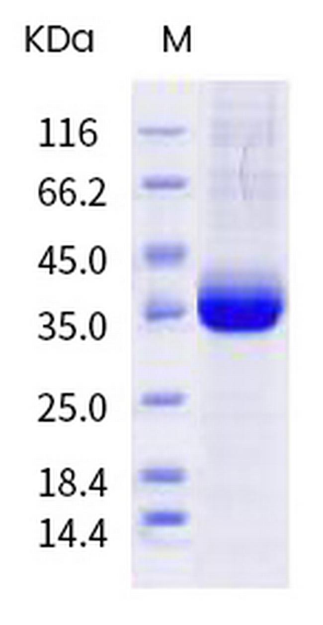 SARS-CoV-2 Spike Protein (RBD) (Y449H) His-tag Protein