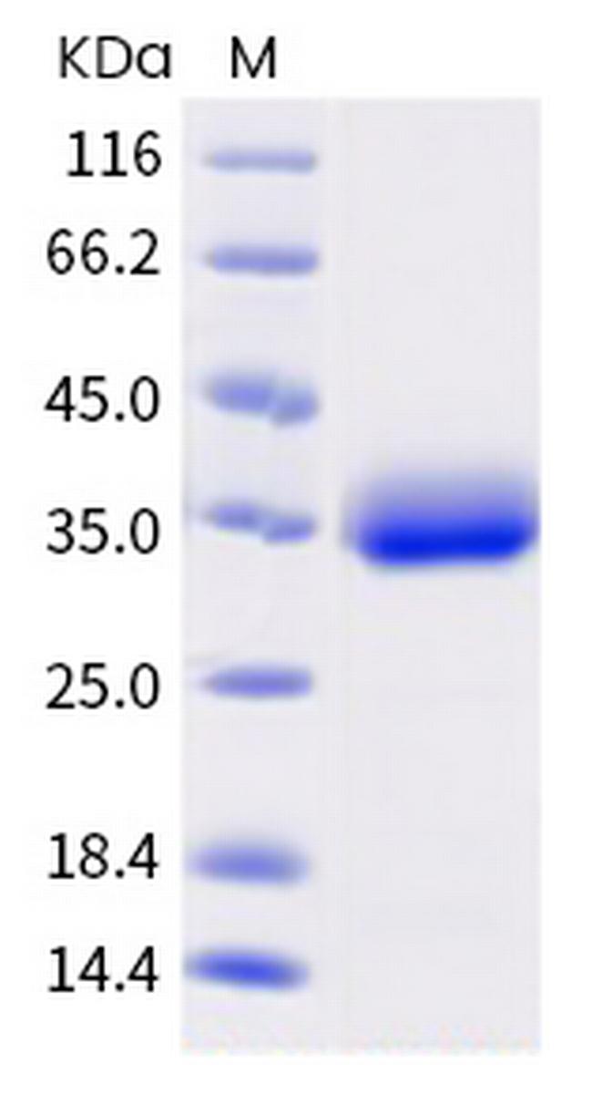 SARS-CoV-2 Spike Protein (RBD) (C.1.2) His-tag Protein