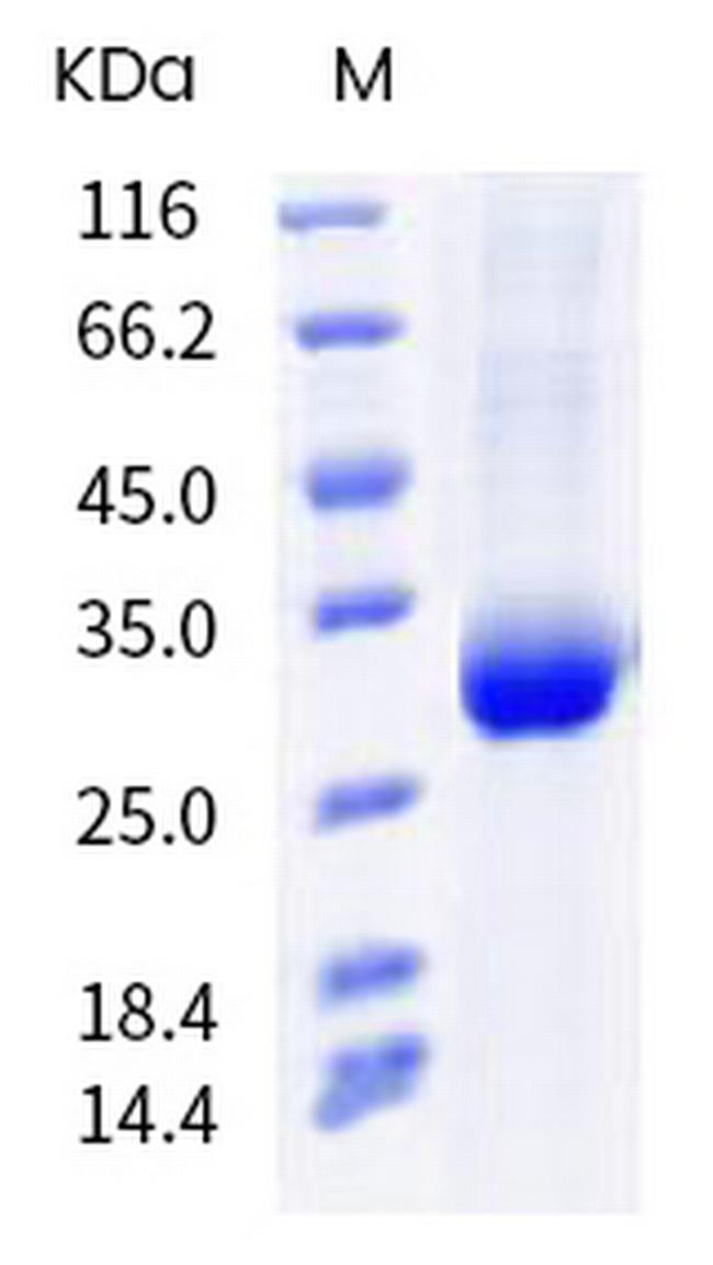 SARS-CoV-2 Spike Protein (RBD) (Y473F) His-tag Protein
