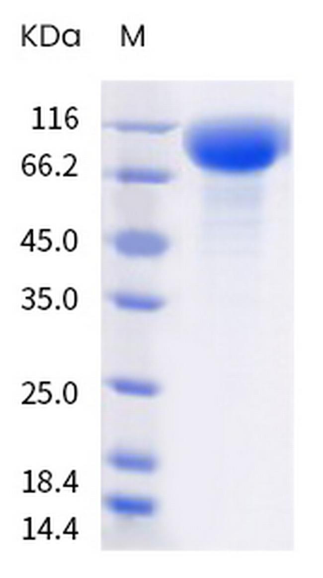 SARS-CoV-2 Spike Protein S1 (B.1.617.2) His-Avi Tag Protein