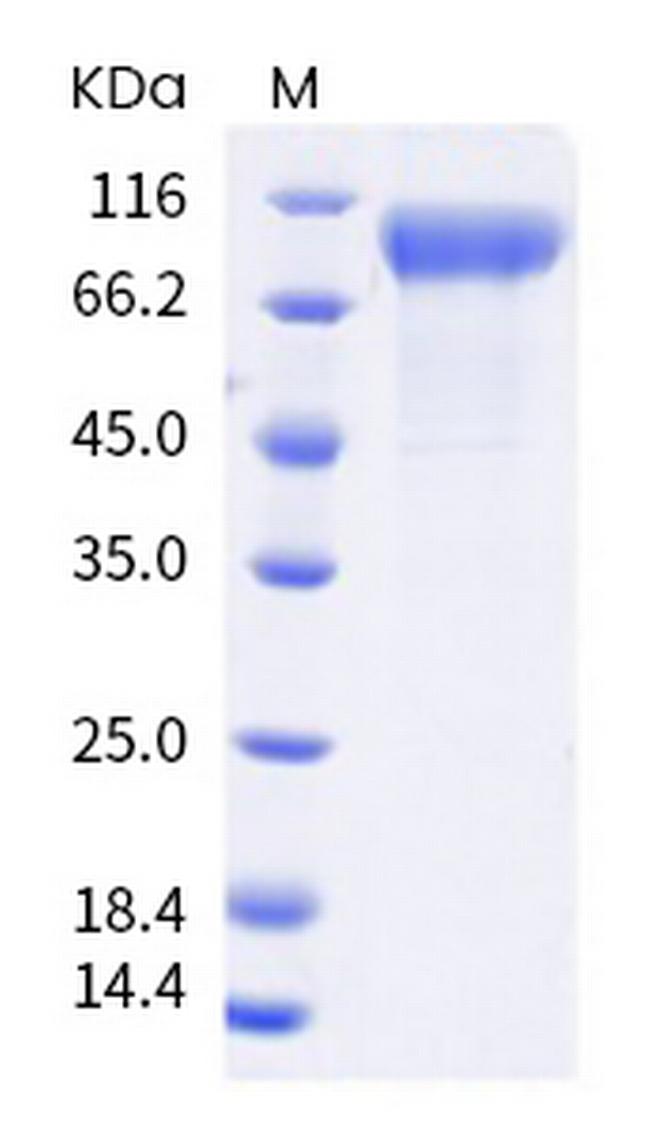 SARS-CoV-2 Spike Protein S1 (B.1.1.7) His-Avi Tag Protein