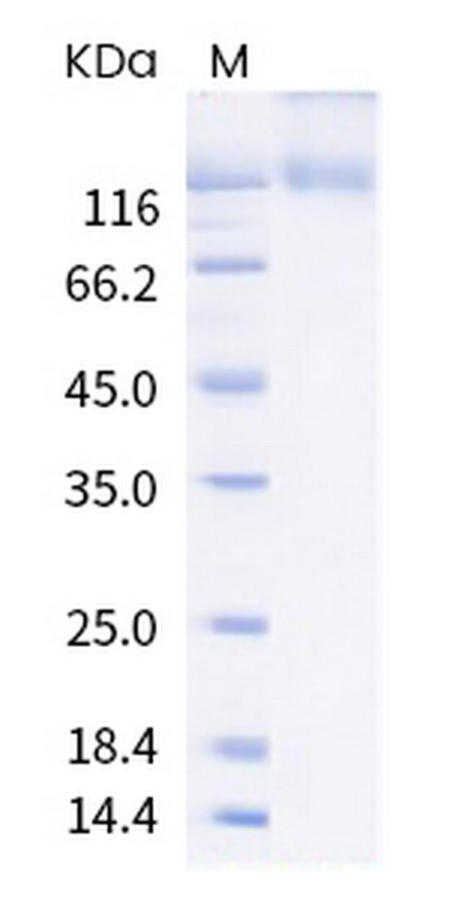SARS-CoV-2 Spike Protein S1 (B.1.526) His-Avi Tag Protein