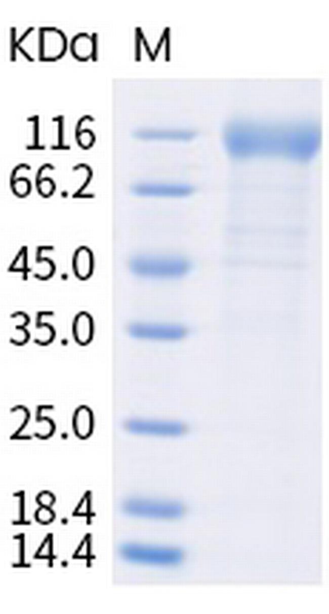 SARS-CoV-2 Spike Protein S1 (B.1.617) His-tag Protein