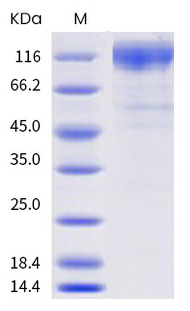 SARS-CoV-2 Spike Protein S1 (P.2) His-tag Protein