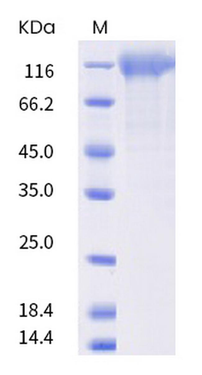 SARS-CoV-2 Spike Protein S1 (C.37) His-tag Protein