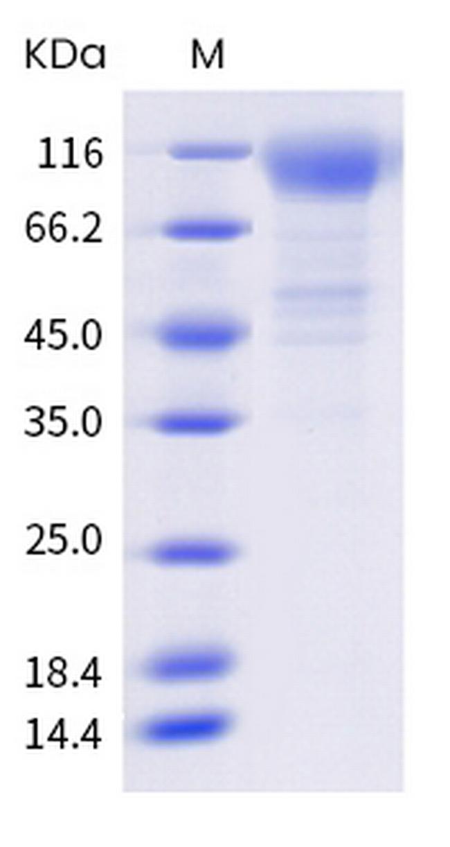 SARS-CoV-2 Spike Protein S1 (C.37) His-tag Protein