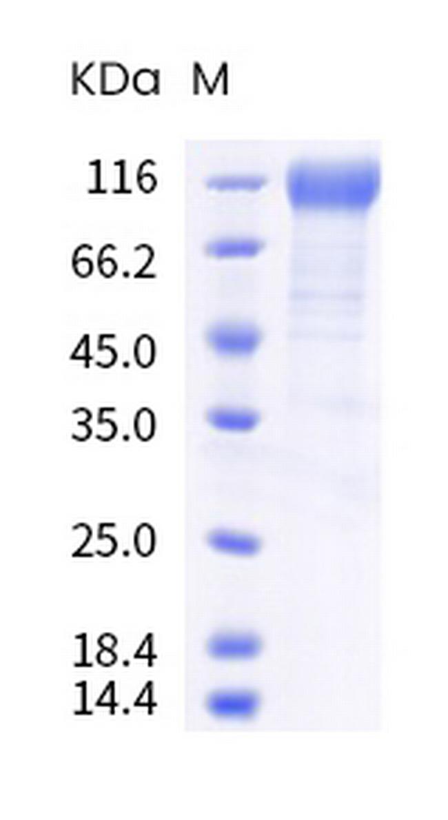SARS-CoV-2 Spike Protein S1 (mutant) His-tag Protein