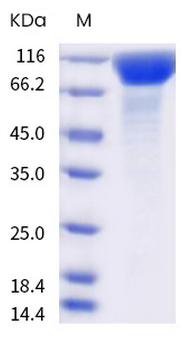 SARS-CoV-2 Spike Protein S1 (P.1) His-Avi Tag Protein