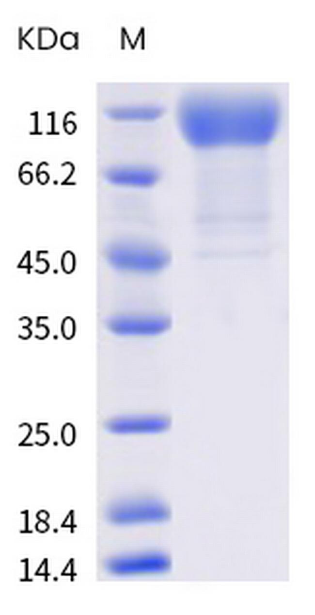 SARS-CoV-2 Spike Protein S1 (B.1.427) His-tag Protein