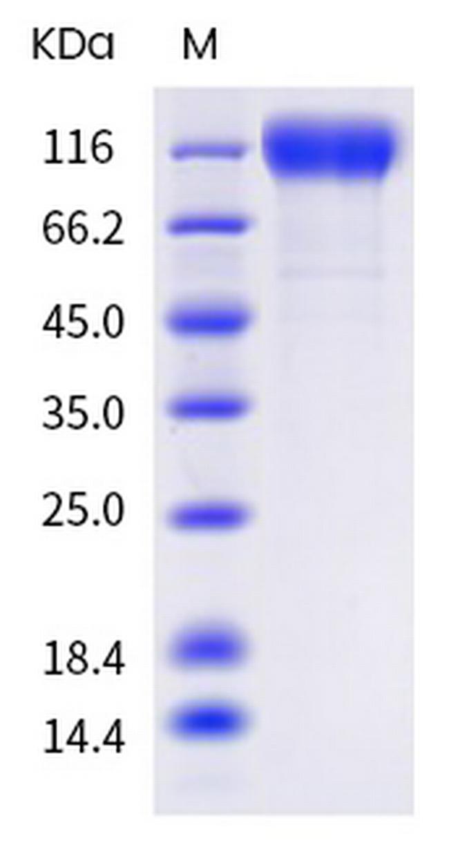 SARS-CoV-2 Spike Protein S1 (C.1.2) His-tag Protein