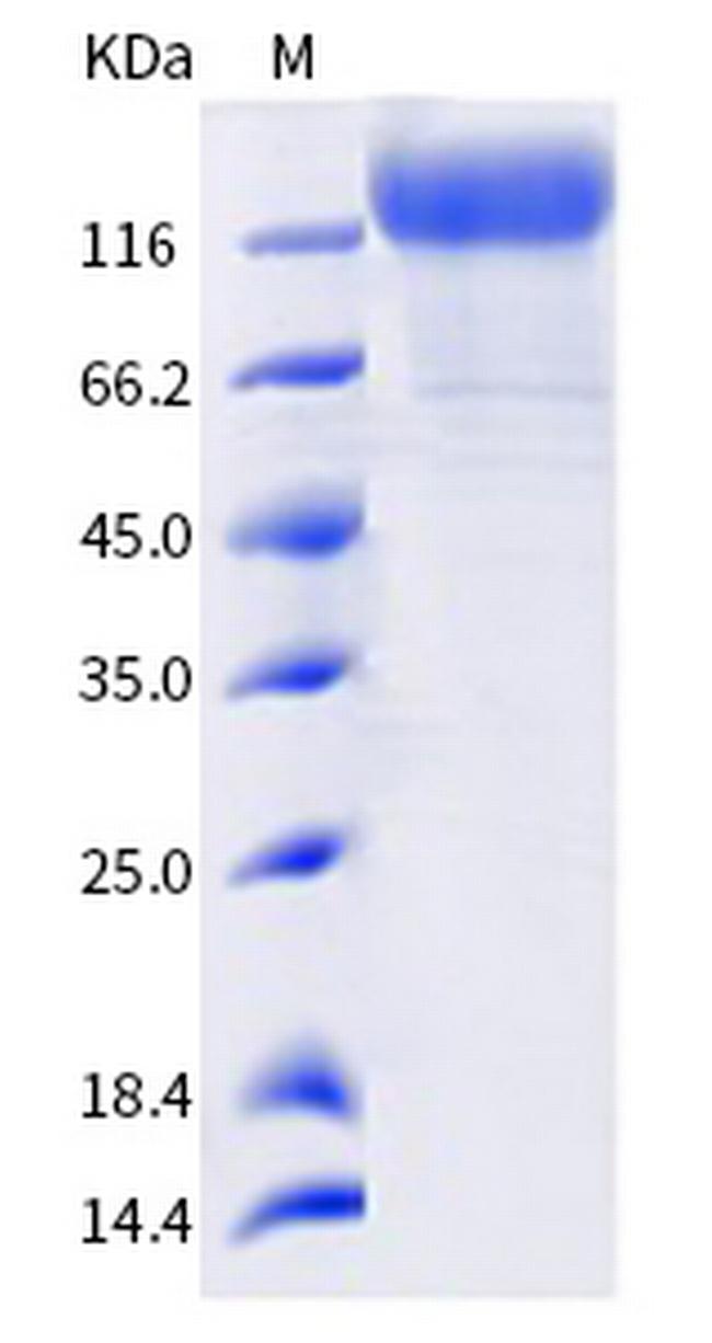 SARS-CoV-2 Spike Protein S1 (AY.3) His-tag Protein