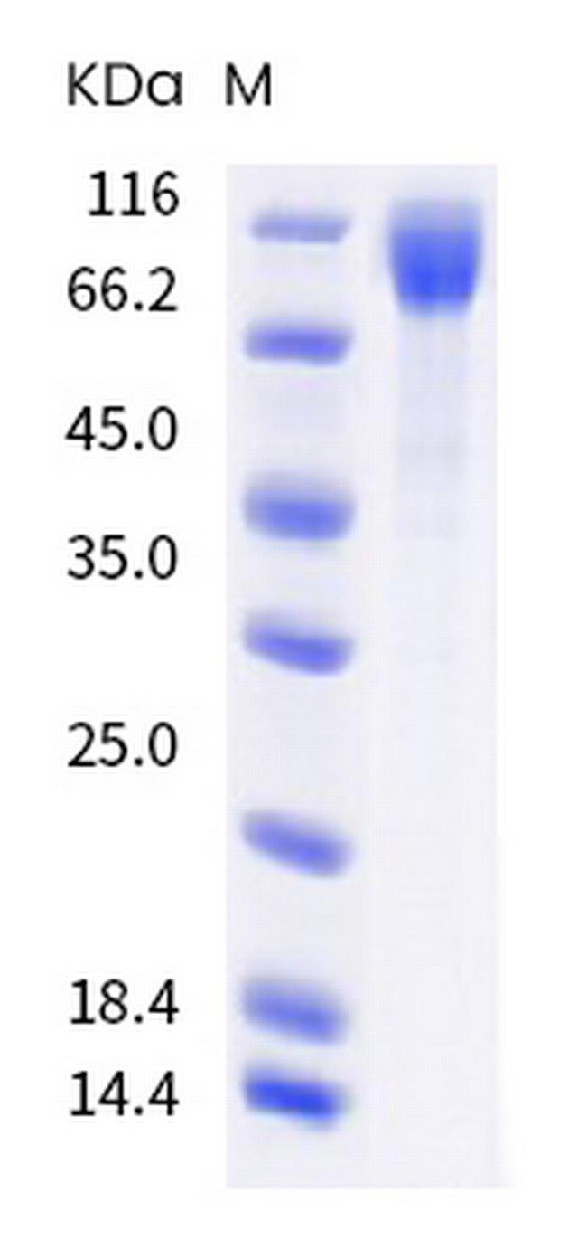 SARS-CoV-2 Spike Protein S1 (B.1.617.2) His-tag Protein