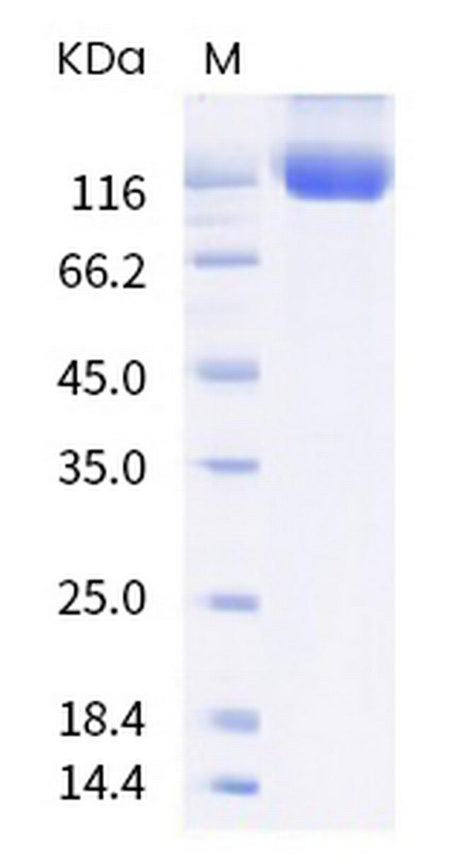 SARS-CoV-2 Spike Protein S1 (B.1.617.3) His-Avi Tag Protein