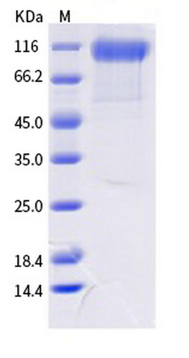 SARS-CoV-2 Spike Protein S1 (AY.1) His-tag Protein
