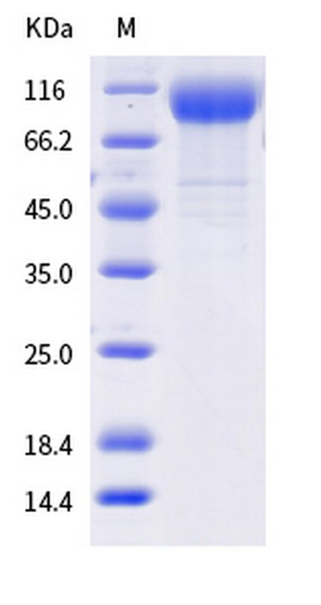 SARS-CoV-2 Spike Protein S1 (AY.2) His-tag Protein
