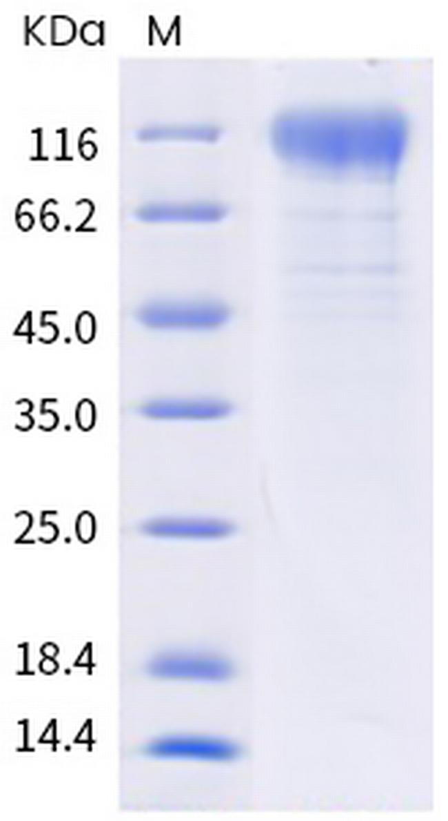 SARS-CoV-2 Spike Protein S1 (B.1.621) His-tag Protein