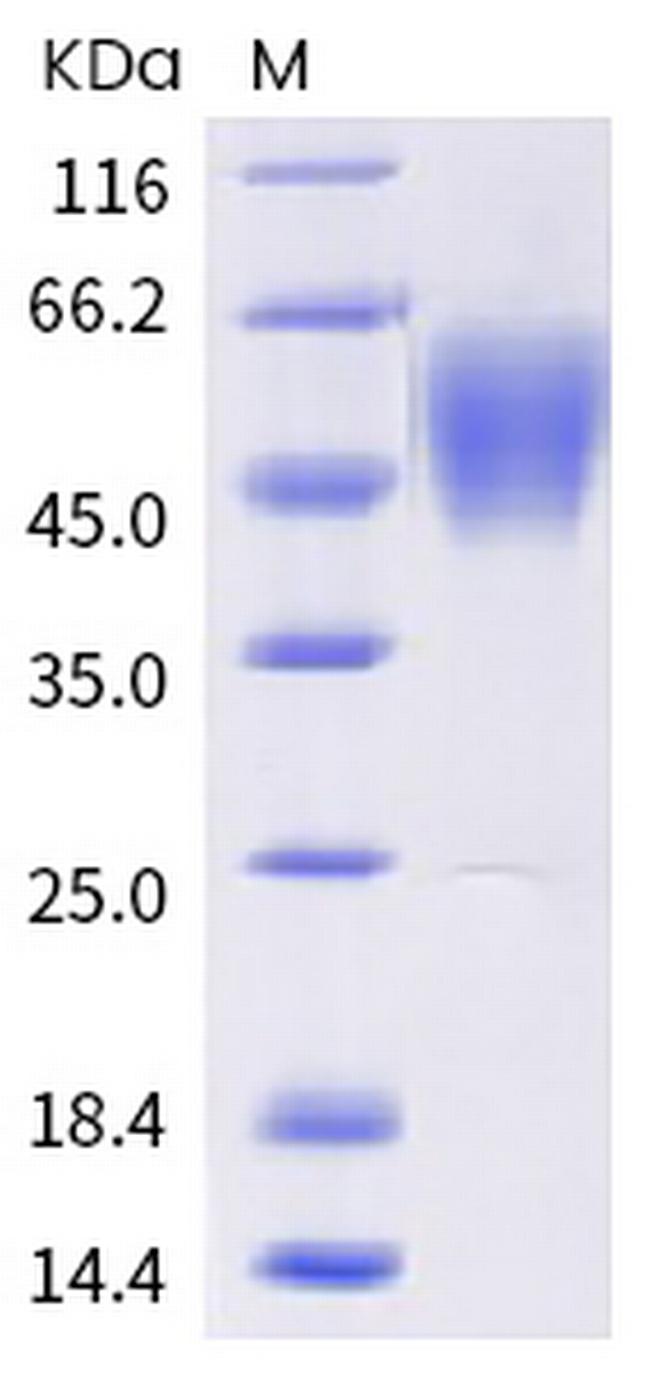 SARS-CoV-2 Spike Protein S1 (mutant) His-tag Protein