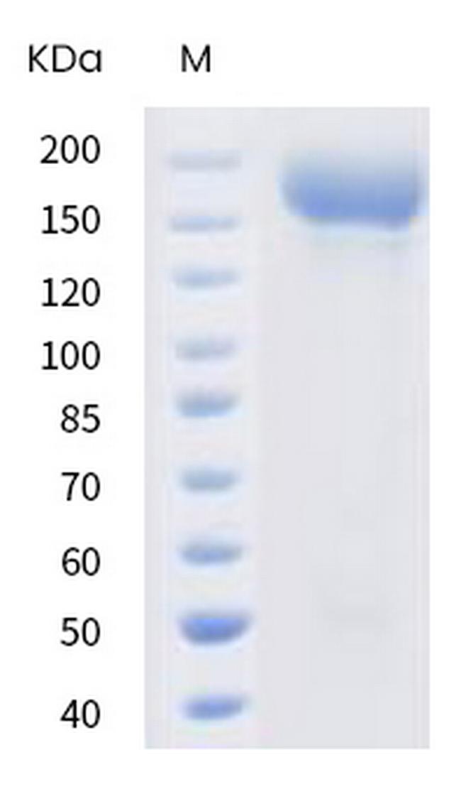 SARS-CoV-2 Spike Protein S1/S2 (D614G) His-tag, trimer Protein