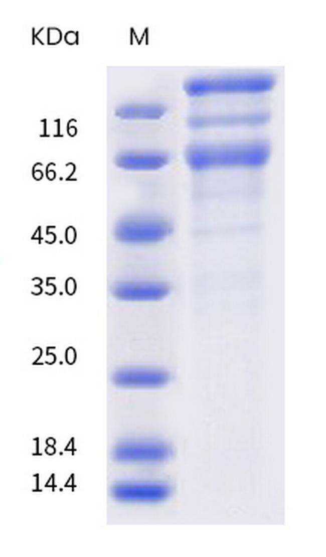 SARS-CoV-2 Spike Protein S1/S2 (P.2) His-tag Protein