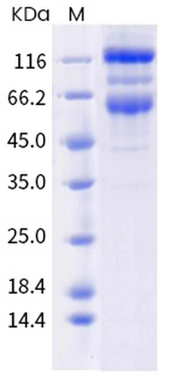 SARS-CoV-2 Spike Protein S1/S2 (mutant) His-tag Protein