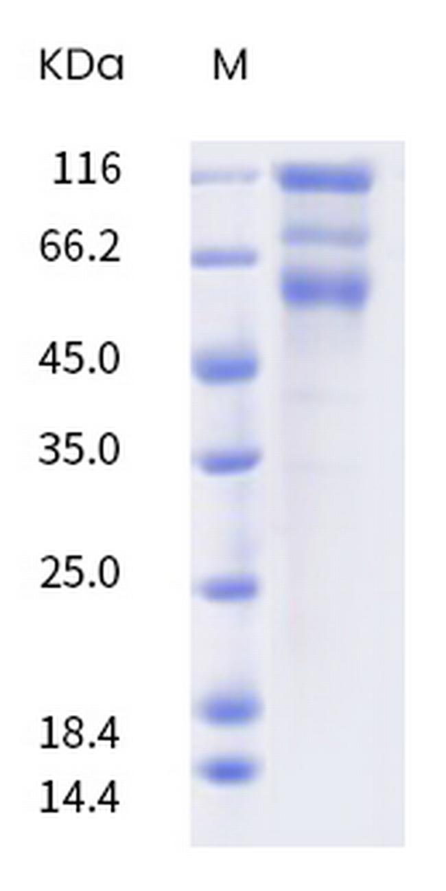 SARS-CoV-2 Spike Protein S1/S2 (B.1.526) His-tag Protein