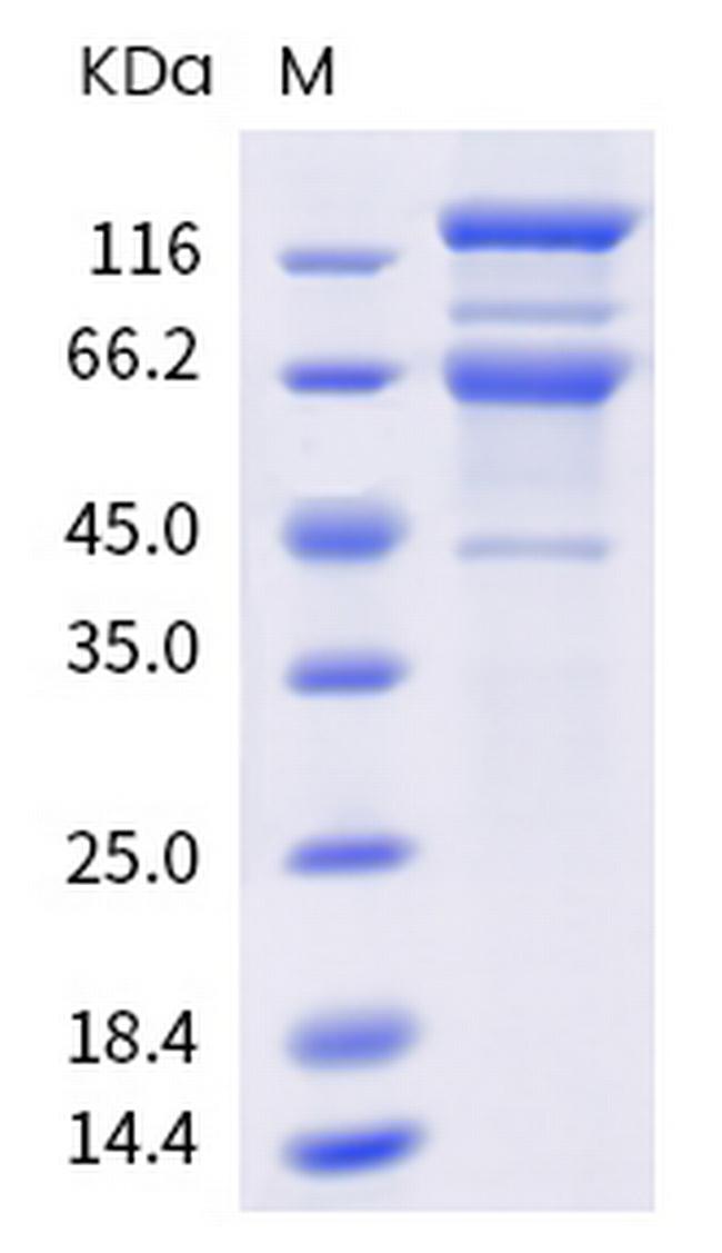 SARS-CoV-2 Spike Protein S1/S2 (B.1.351) His-Avi Tag Protein