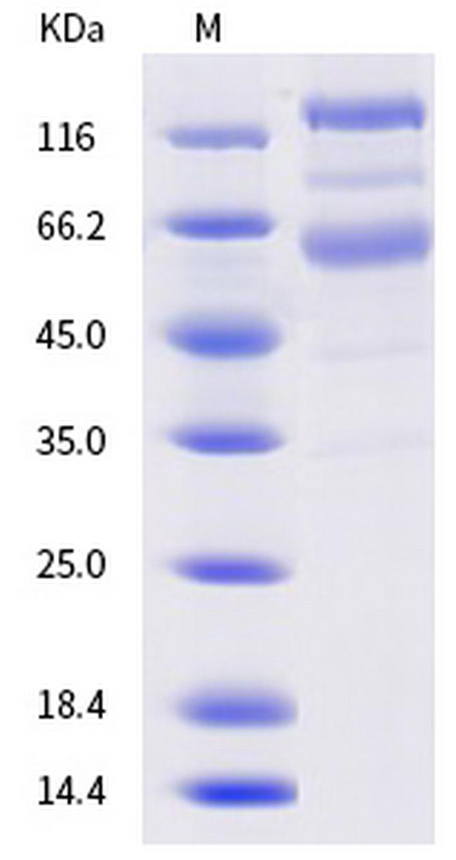 SARS-CoV-2 Spike Protein S1/S2 (B.1.620) His-tag Protein