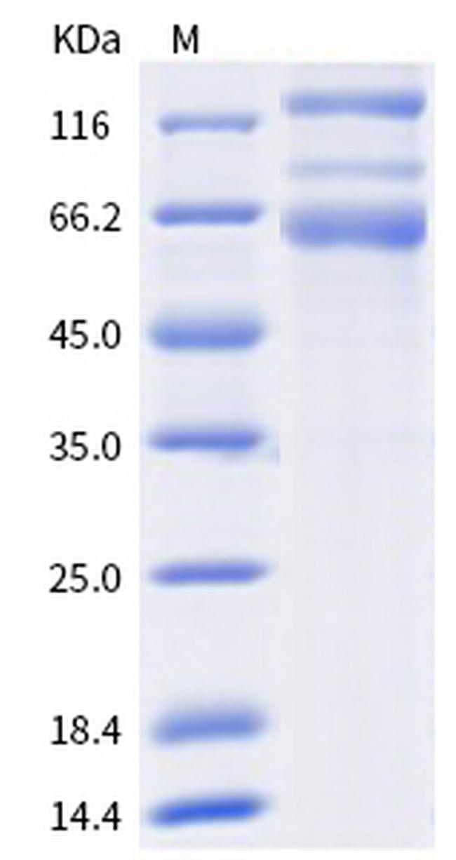 SARS-CoV-2 Spike Protein S1/S2 (C.37) His-tag Protein